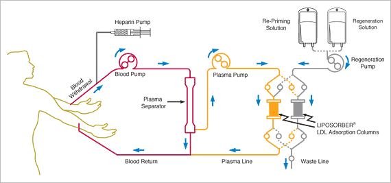 How the LIPOSORBERLA system works