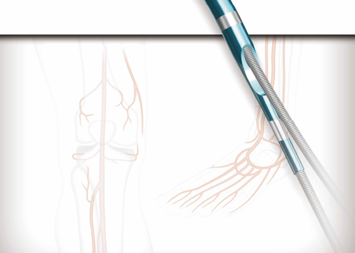 カネカ貫通カテーテル　ＰＥ－ＲＷ１