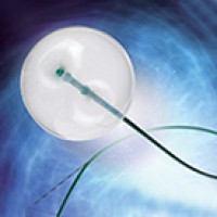 エクストラクションバルーンカテーテル ヒュージュ